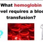 What hemoglobin level requires a blood transfusion?